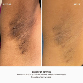 Bushbalm Bermuda oil dropper releasing a drop to soothe and hydrate skin