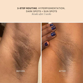 using Bushbalm underarm to hydrate and brighten skin benefit