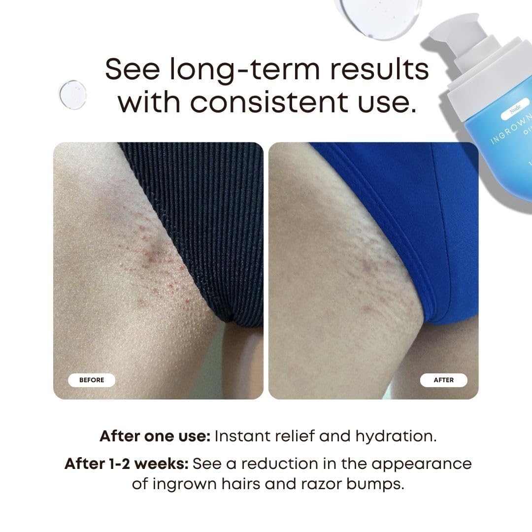 Bushbalm open dropper releasing oil, highlighting texture and easy precise application