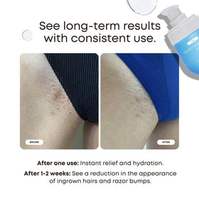 Bushbalm open dropper releasing oil, highlighting texture and easy precise application
