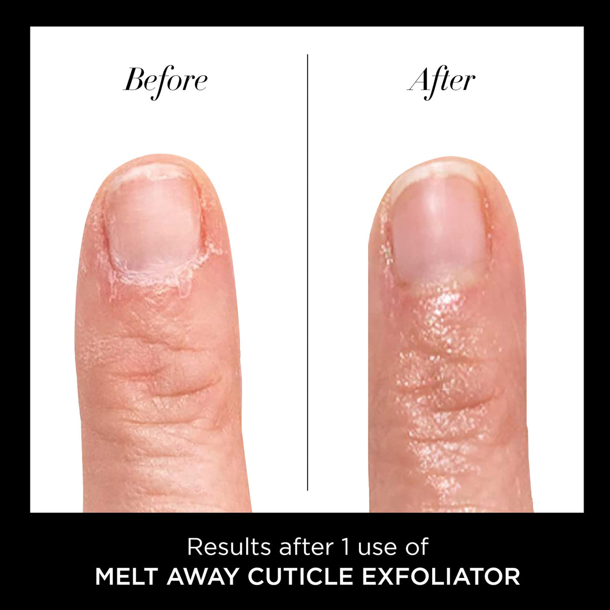 butter LONDON after manicure neat nail beds highlighting smoother edges