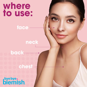 Bye Bye Blemish bottle size next to a coin showing compact 1oz travel-friendly benefit