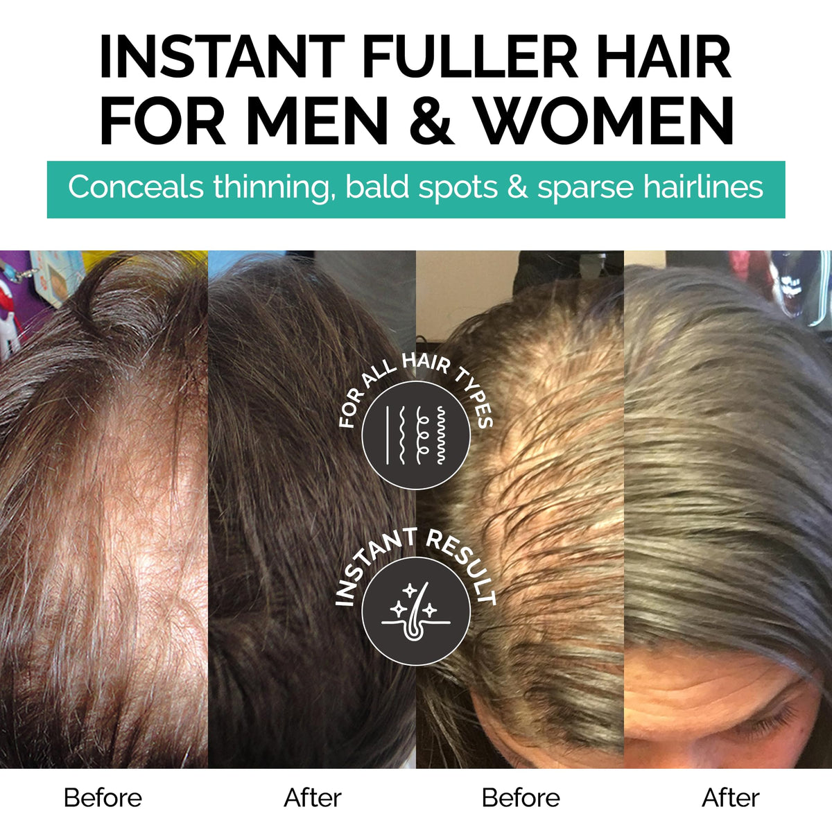 Caboki applied on hairline demonstrating instant concealment benefit