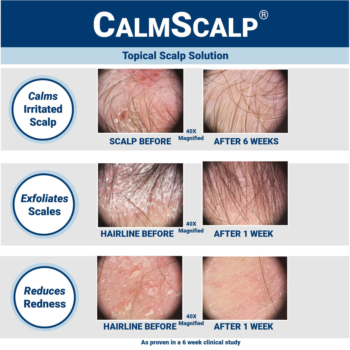 CalmScalp serum texture close-up highlighting lightweight, non-greasy absorption