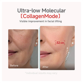 CANDORLOV side view after mask use showing improved skin smoothness