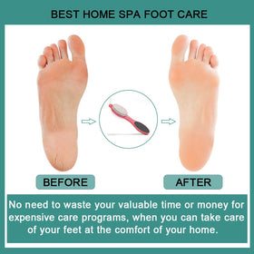 CAREHOOD in-use demonstration gently treating a heel for visible improvement