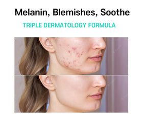 CARE:NEL model applying cream to cheek demonstrating application ease