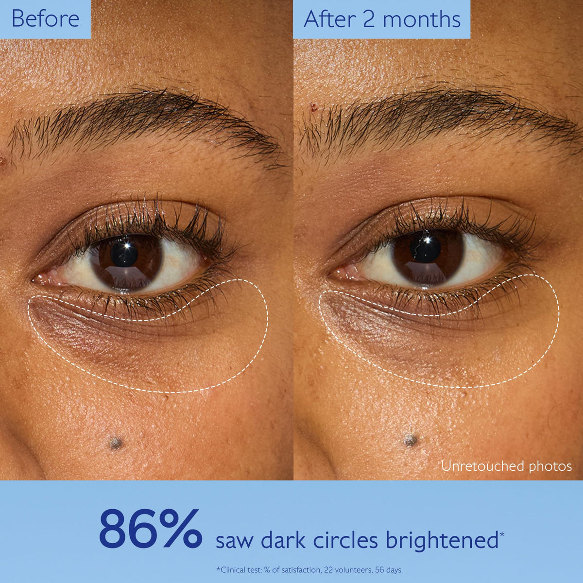 Caudalie caffeine ingredient visual highlighting de-puffing action for refreshed eyes