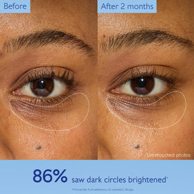 Caudalie caffeine ingredient visual highlighting de-puffing action for refreshed eyes