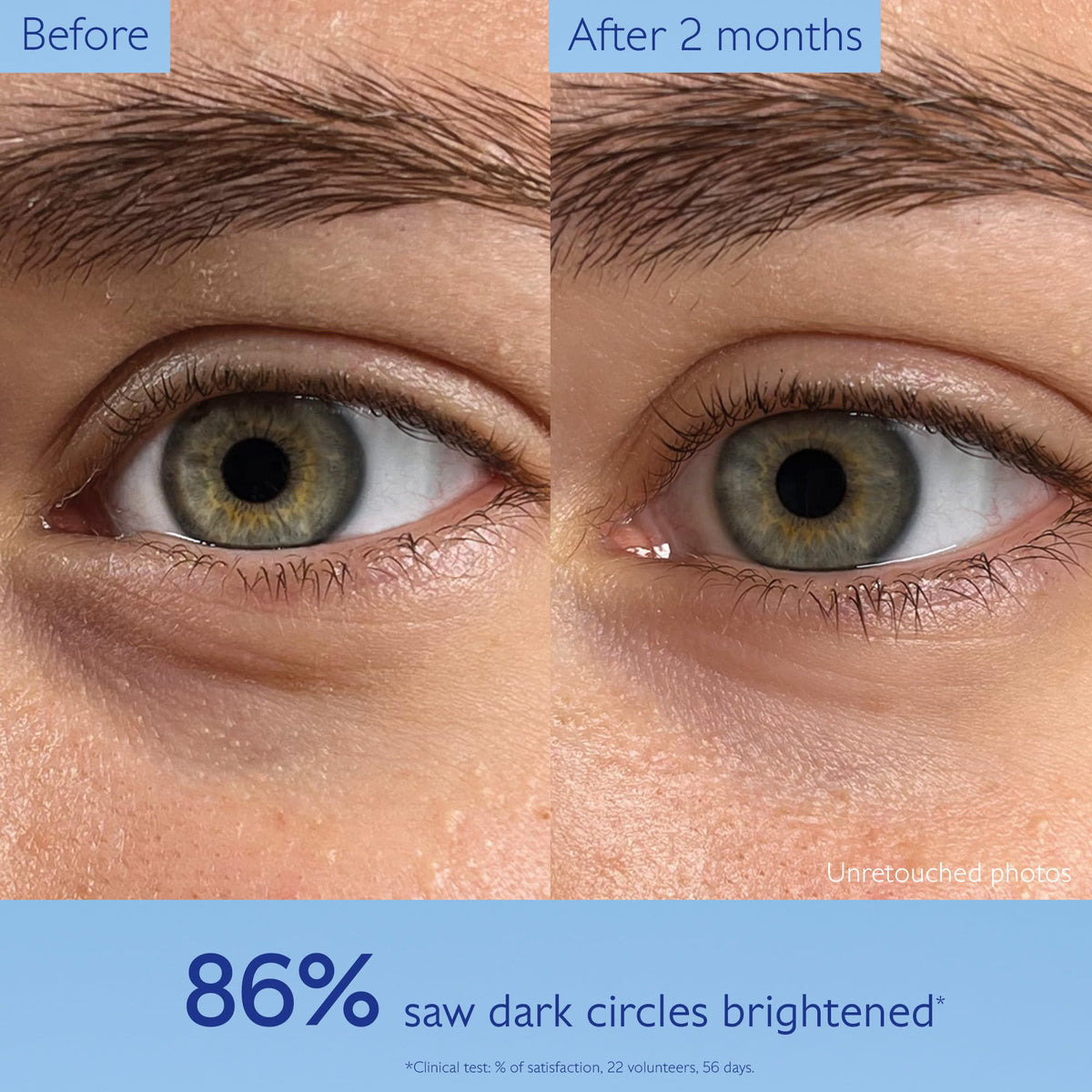 Caudalie niacinamide ingredient visual emphasizing brightening and even-tone benefit