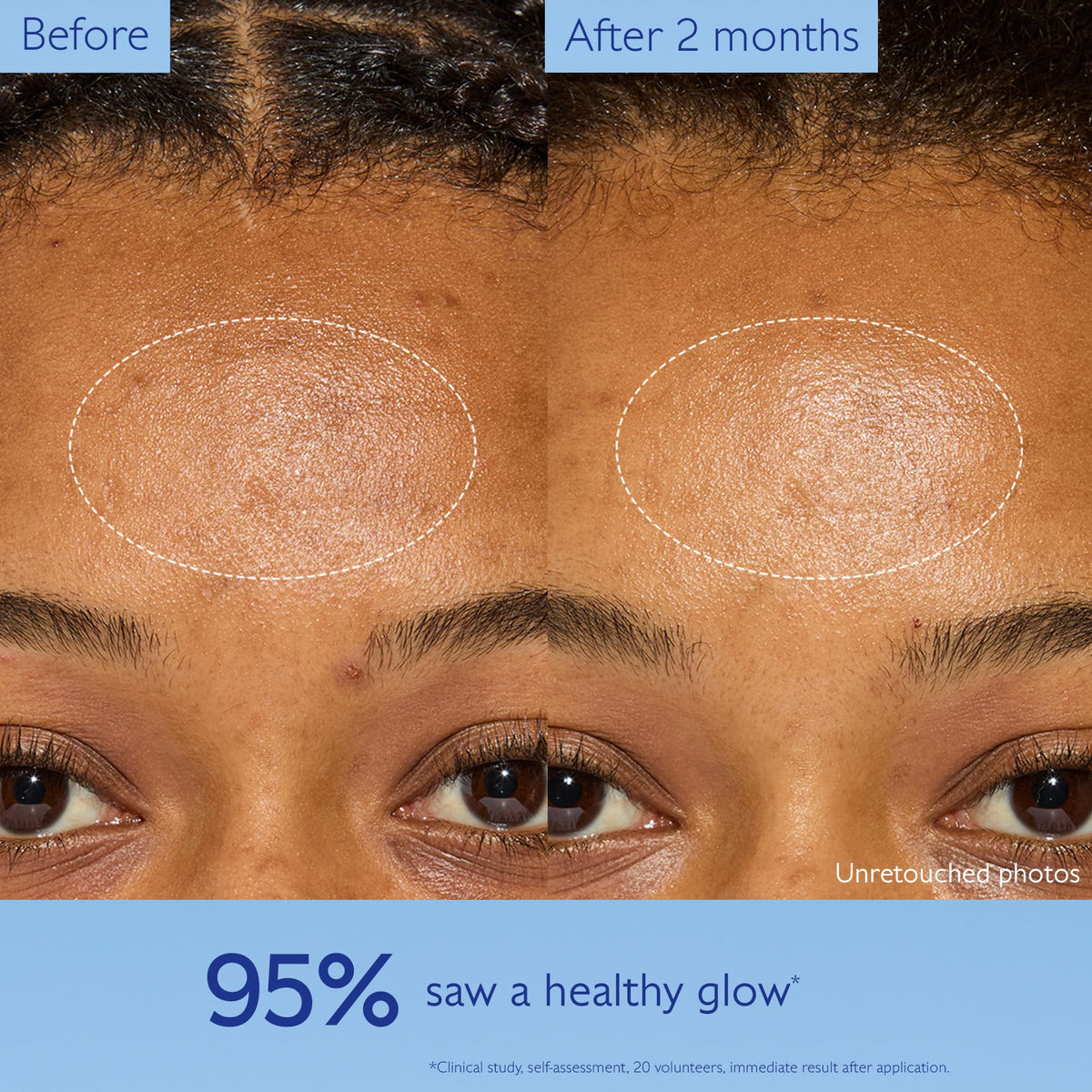 Caudalie viniferine ingredient visual emphasizing targeted brightening benefit