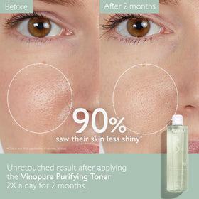 Caudalie Vinopure close-up label highlighting natural salicylic acid benefits