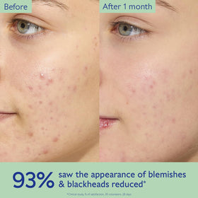 Caudalie Vinopure cream texture close-up, lightweight gel-cream demonstrating non-greasy hydration