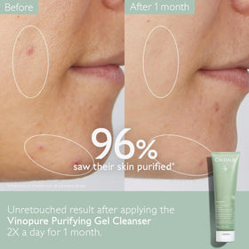 Caudalie Vinopure grape water ingredient highlighting hydration benefit