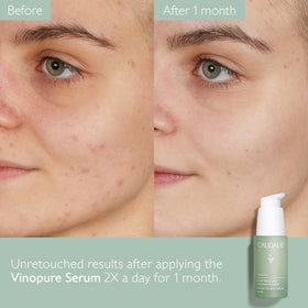 Caudalie Vinopure label close-up showing niacinamide and key benefits