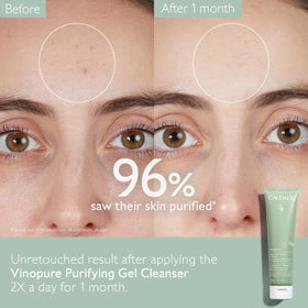 Caudalie Vinopure gel dispensed from pump for controlled application