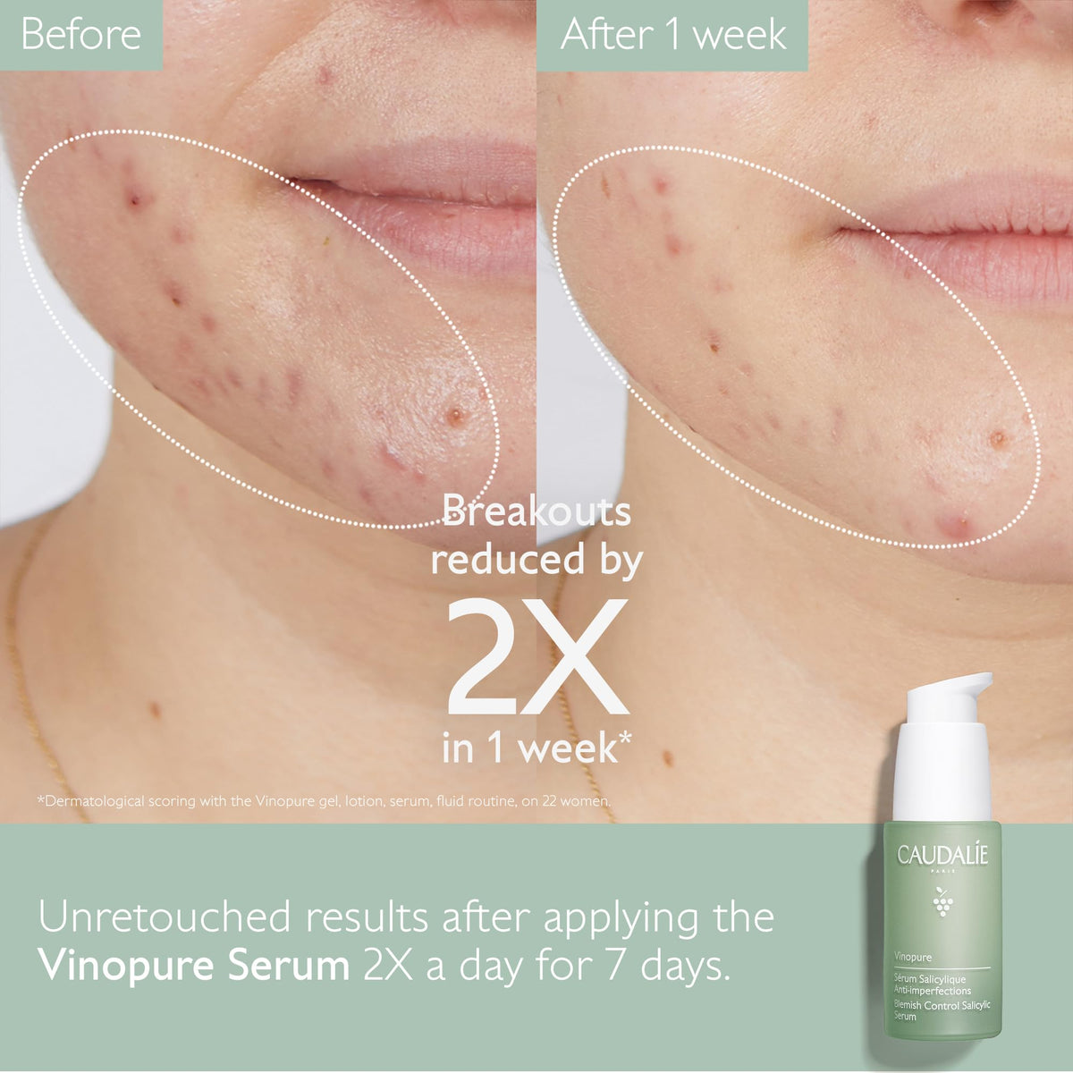 Caudalie Vinopure serum texture on skin demonstrating lightweight absorption