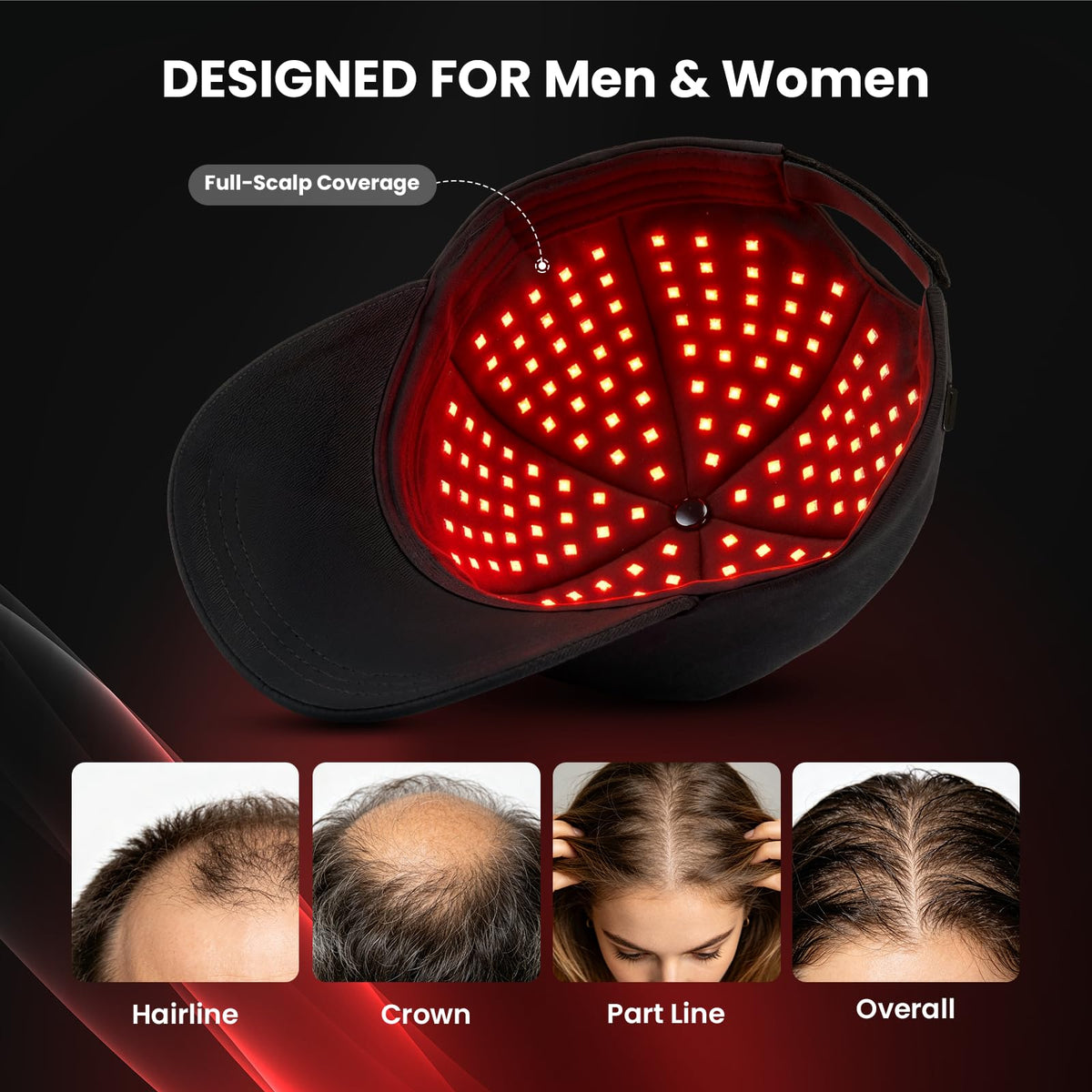 CAYAMA interior LED layout close-up highlighting 528 emitters for even scalp illumination