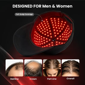 CAYAMA interior LED layout close-up highlighting 528 emitters for even scalp illumination
