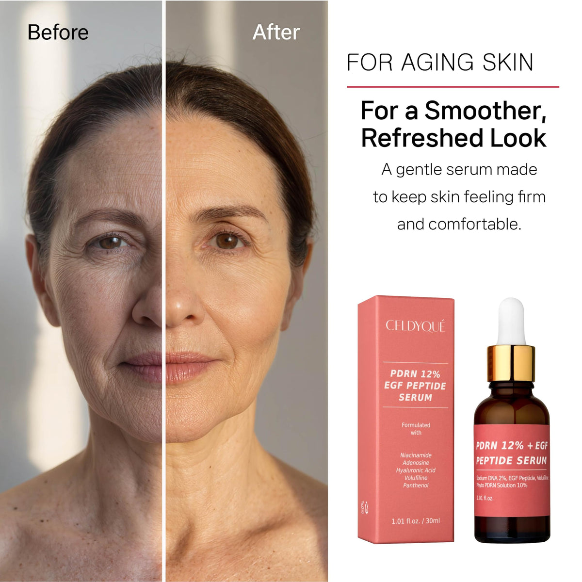 CELDYQUE serum beside microneedling roller for treatment pairing