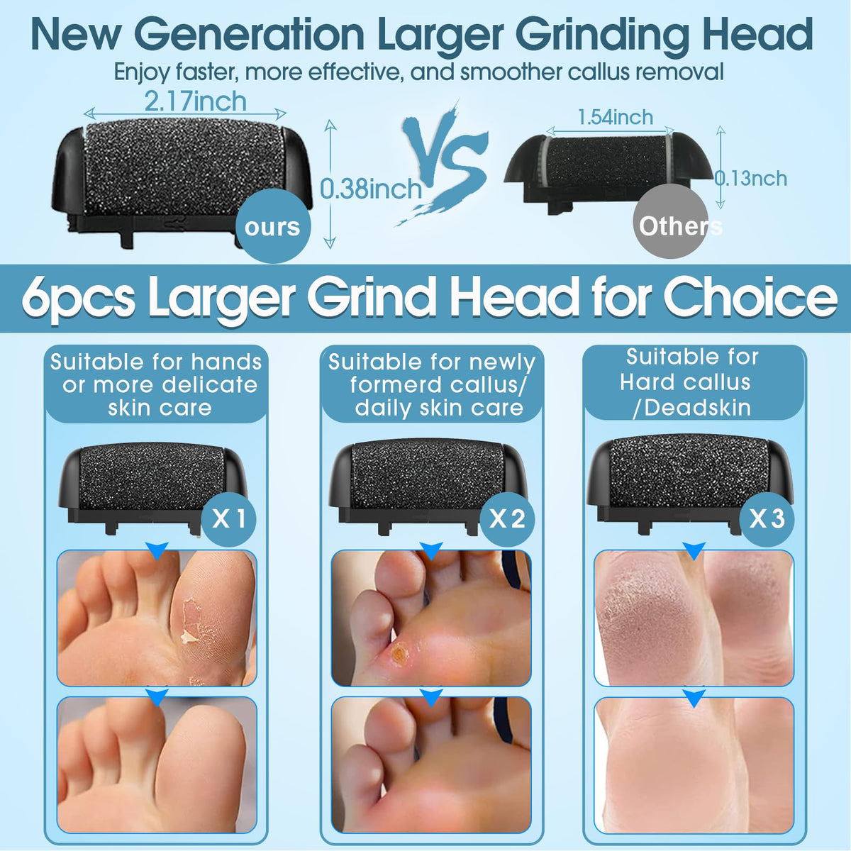 Celepen in use on a heel demonstrating gentle callus removal and visible smoother skin benefits