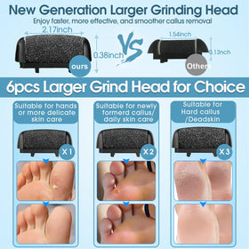 Celepen in use on a heel demonstrating gentle callus removal and visible smoother skin benefits