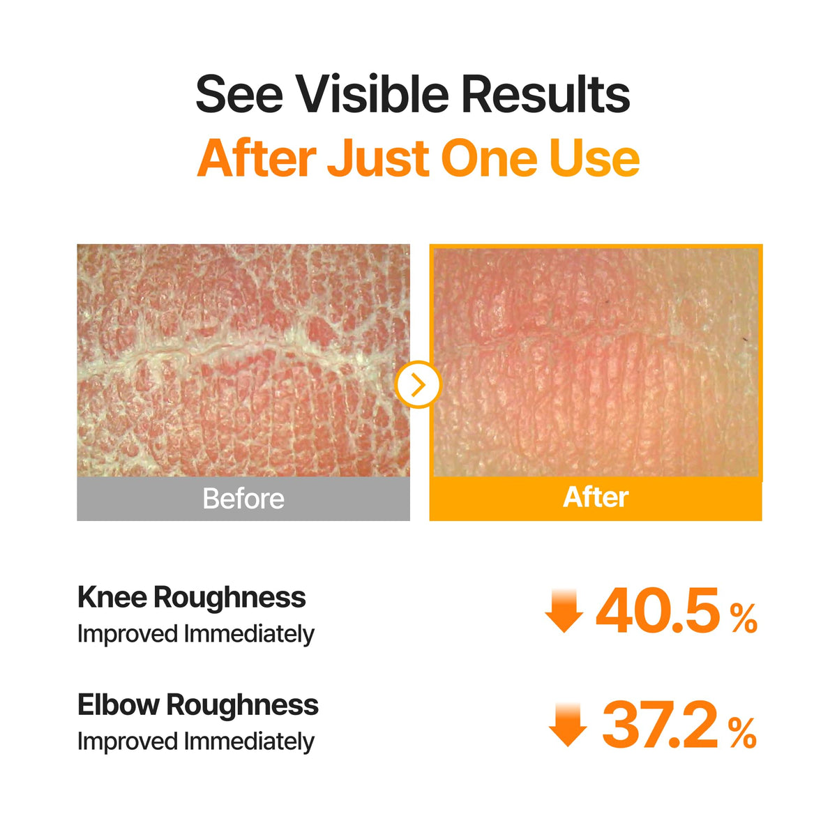person applying celimax pad to underarm, illustrating post-shave soothing and refining benefit