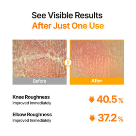 person applying celimax pad to underarm, illustrating post-shave soothing and refining benefit