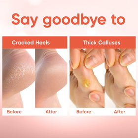 CÉLOR smooth heels after peel close-up showing softer skin benefit