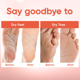 CÉLOR booties being worn during treatment for comfortable at-home peel benefit