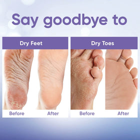 CÉLOR before and after feet showing smoother heels and softer skin benefit