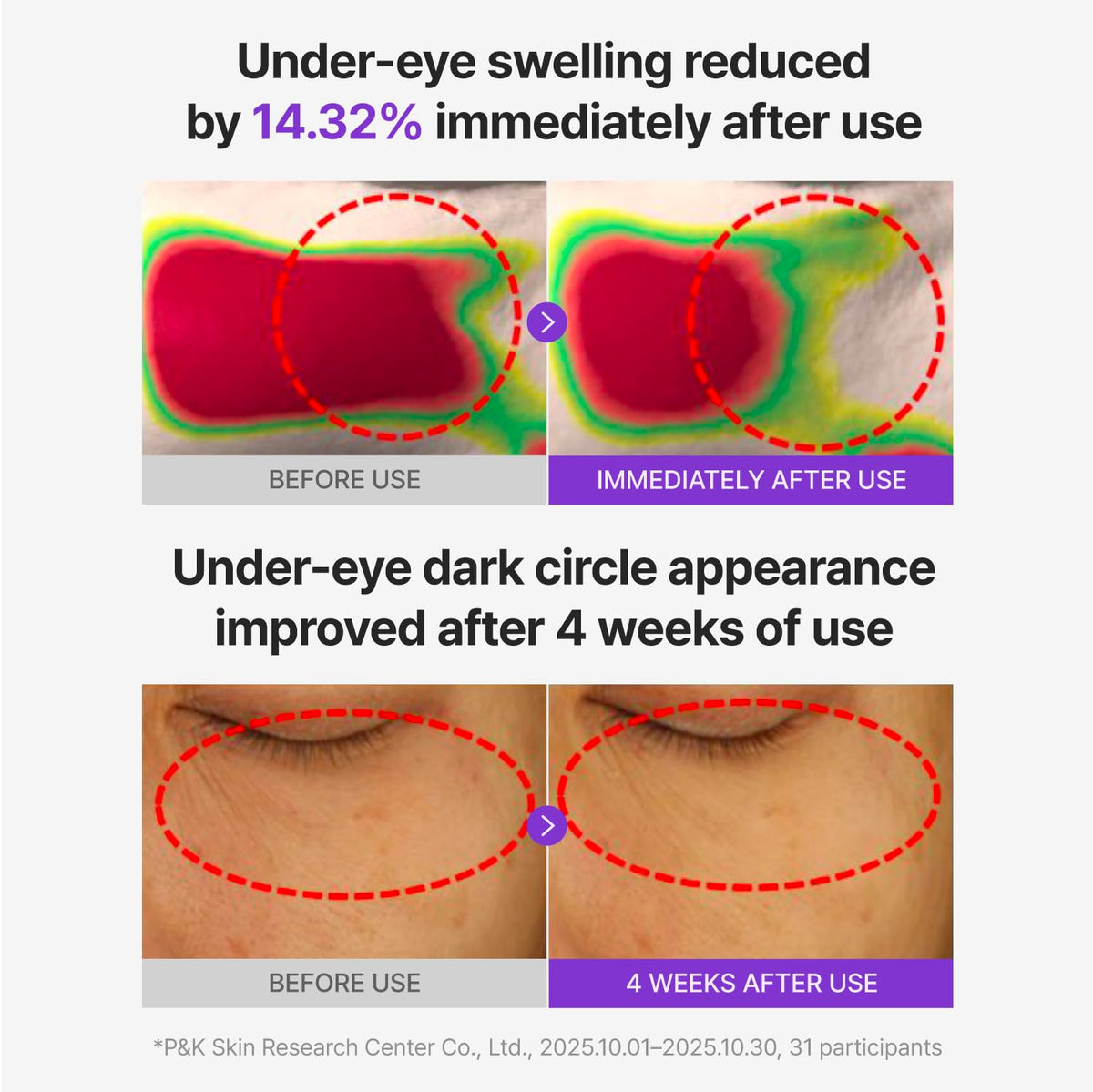 CENTELLIAN 24 patch applied under eye, cooling lift and de-puffing