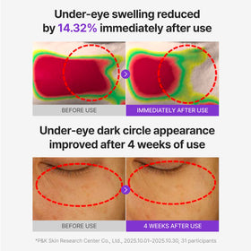 CENTELLIAN 24 patch applied under eye, cooling lift and de-puffing