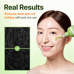 CENTELLIAN 24 charcoal capsules detail illustrating impurity absorption benefit