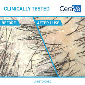 CeraVe close-up of 1% pyrithione zinc ingredient for flake reduction