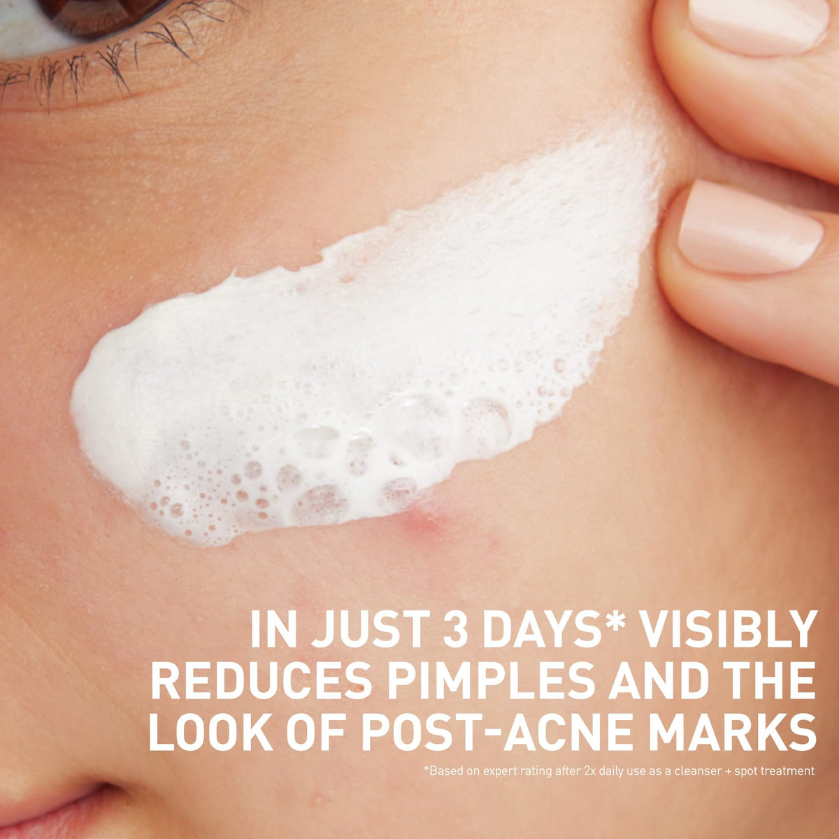 CeraVe applied as clay mask on cheek absorbing oil and impurities