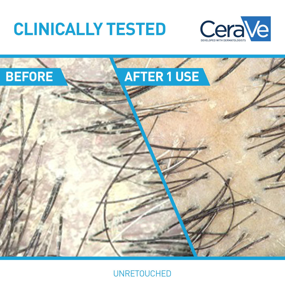 CeraVe conditioner tube open showing creamy formula and hydration benefit