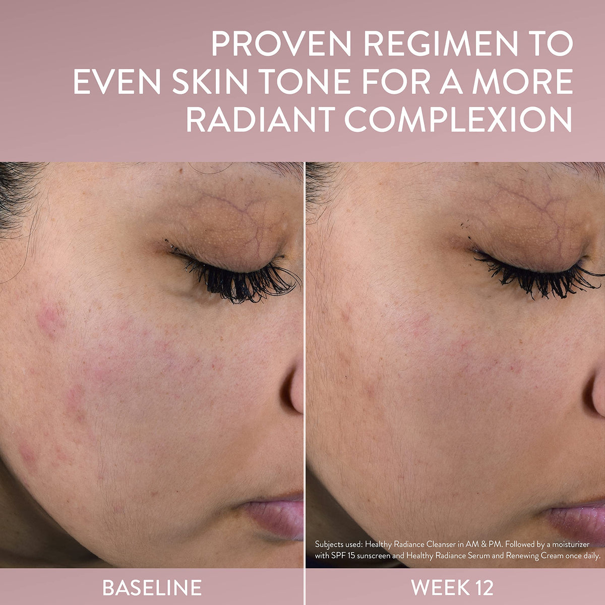 Cetaphil before and after skin tone comparison showing improved radiance