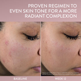 Cetaphil before and after skin tone comparison showing improved radiance