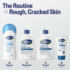 Using Cetaphil on elbow showing repair of rough, cracked skin
