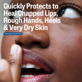 Cetaphil ointment on fingers demonstrating easy spread and repair benefit