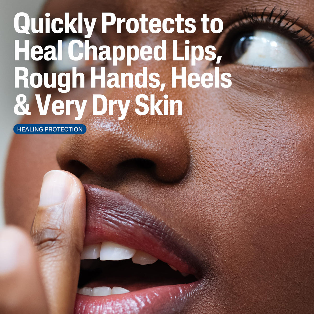 Applying Cetaphil ointment to dry skin on hand to soothe and protect