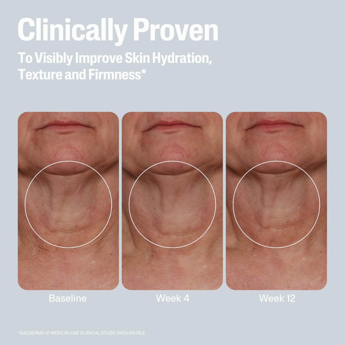 Cetaphil mandelic acid ingredient visual emphasizing gentle renewal