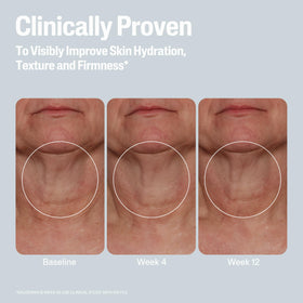 Cetaphil ingredient visual mandelic acid and CICA emphasizing renewal and barrier support