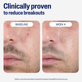 Dispensing Cetaphil cleanser from tube illustrating controlled dose and easy application