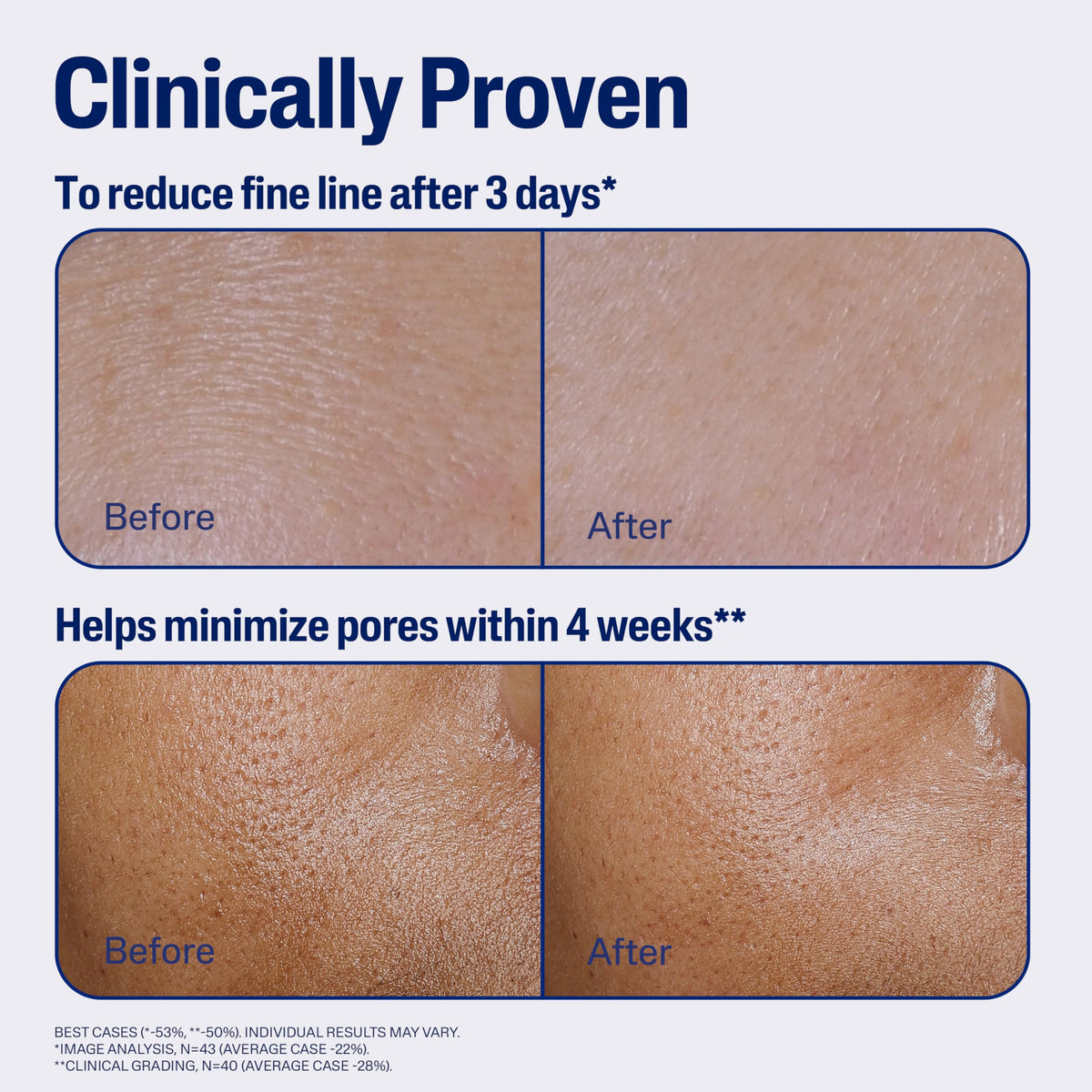Cetaphil serum on hand to show amount and skin-absorption benefit