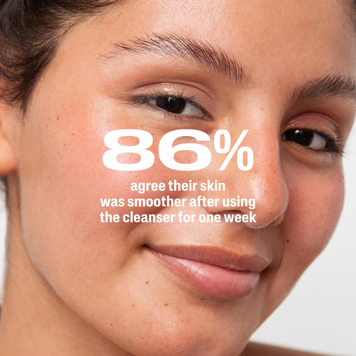 Before-and-after styled image suggesting clearer skin improvement using Cetaphil product