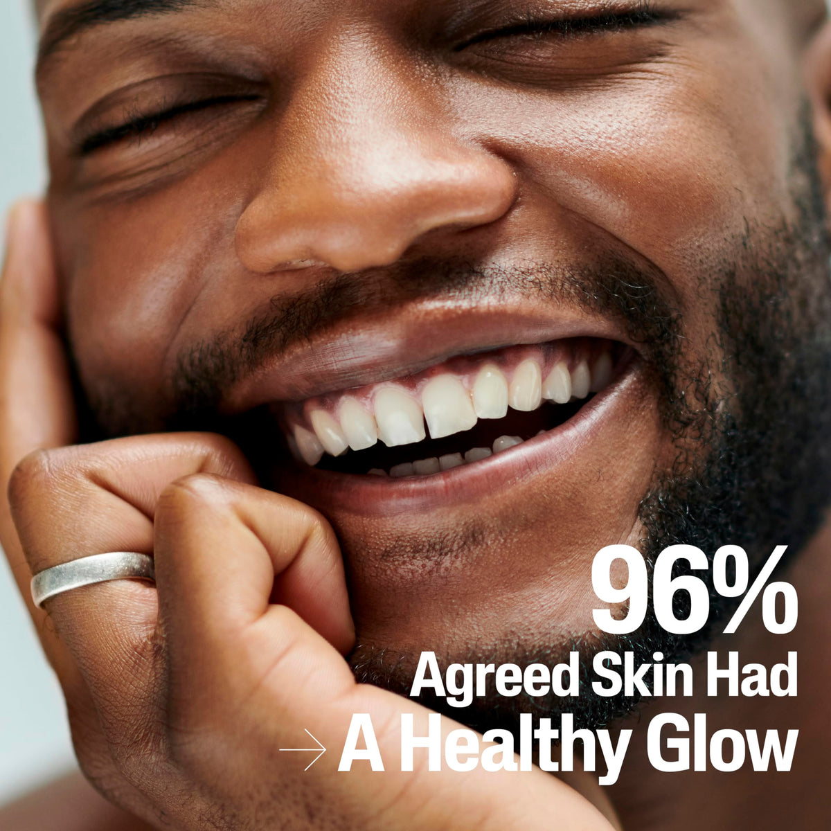 cetaphil before and after skin texture comparison showing smoother skin