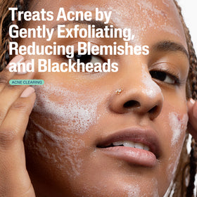 Cetaphil gel texture close-up showing lightweight foam and gentle exfoliation benefit