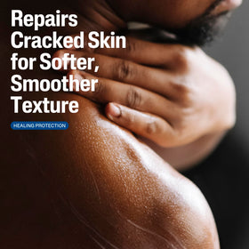 Cetaphil lotion texture swiped on skin illustrating lightweight hydration